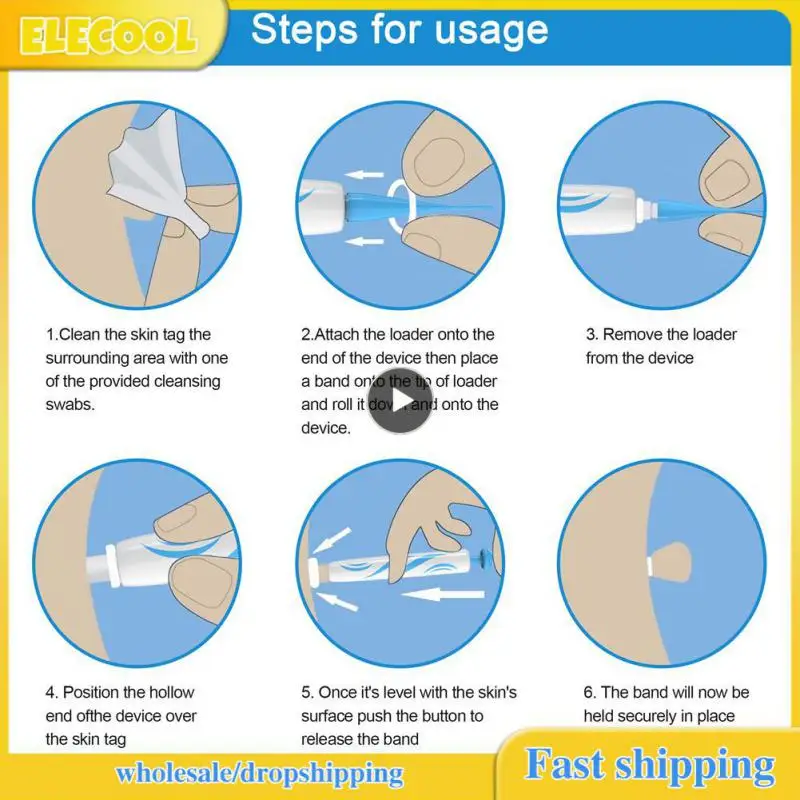 

1~8PCS Replacement Warts Rubber Ring Rubber Ring Tagband 4-8MM 2-4MM For Painless Skin Tag Mole Wart Removal Warts Bands Tool