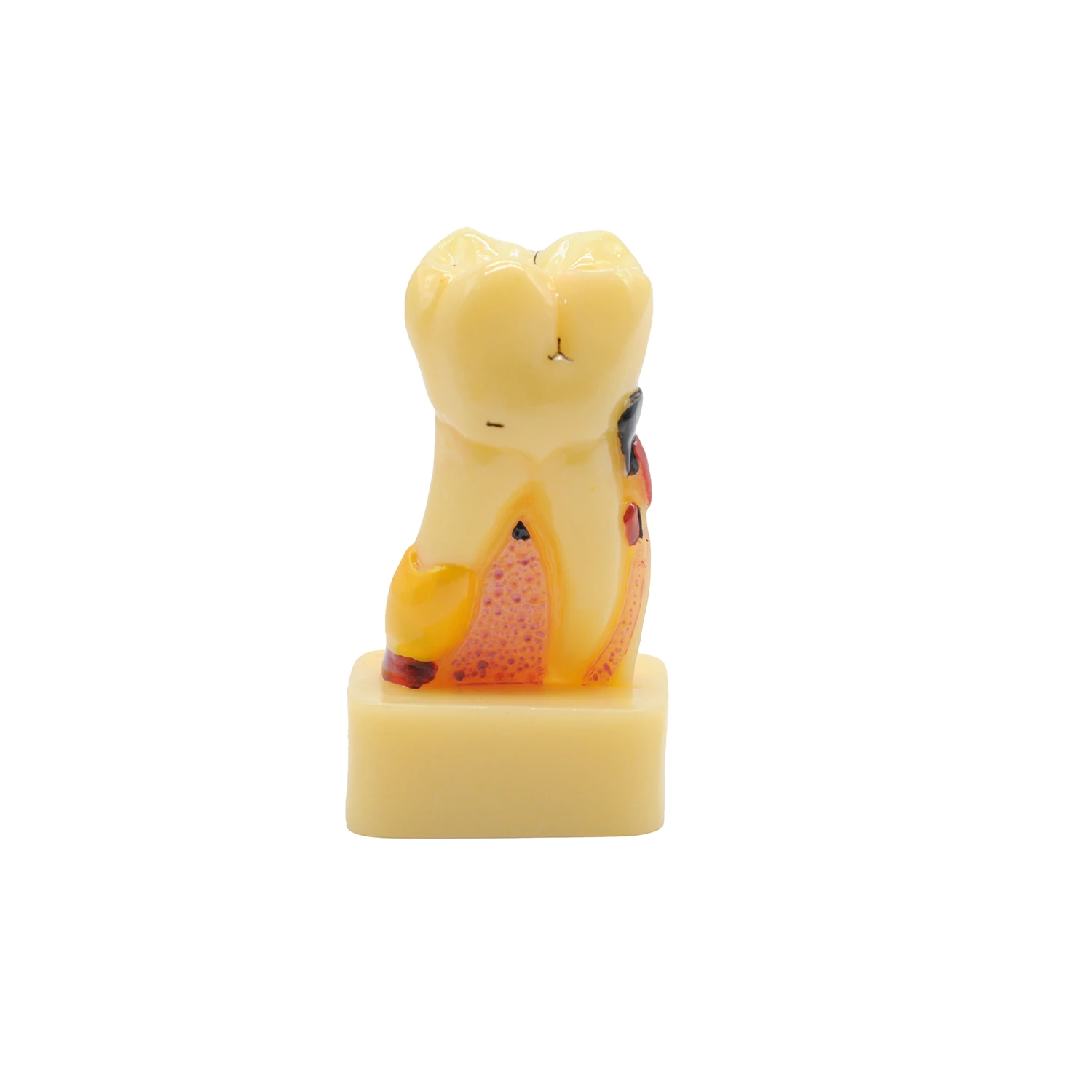 1 шт. стоматологическая нейроанатомия и базовая обучающая модель зубных болезней