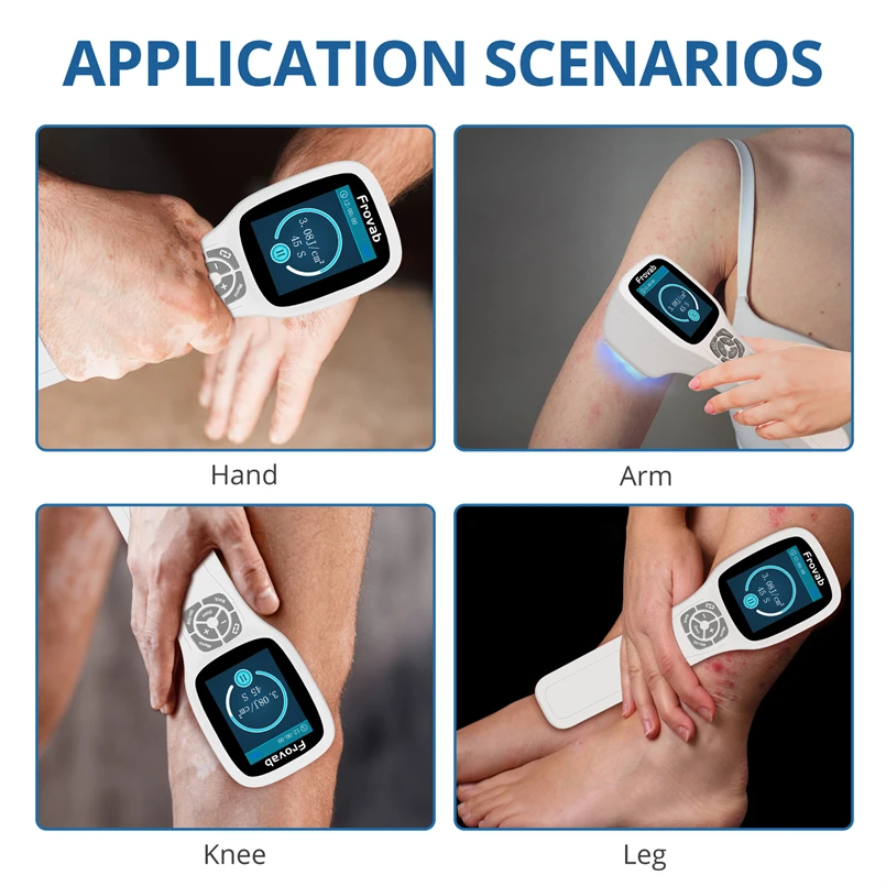 Медицинское устройство для лечения пятен экземы Нм