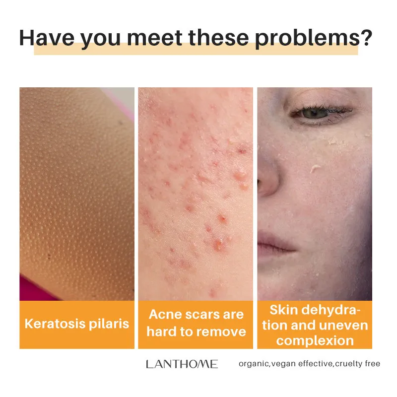 Рисунок 5 - Черное осветляющее кожу мыло с