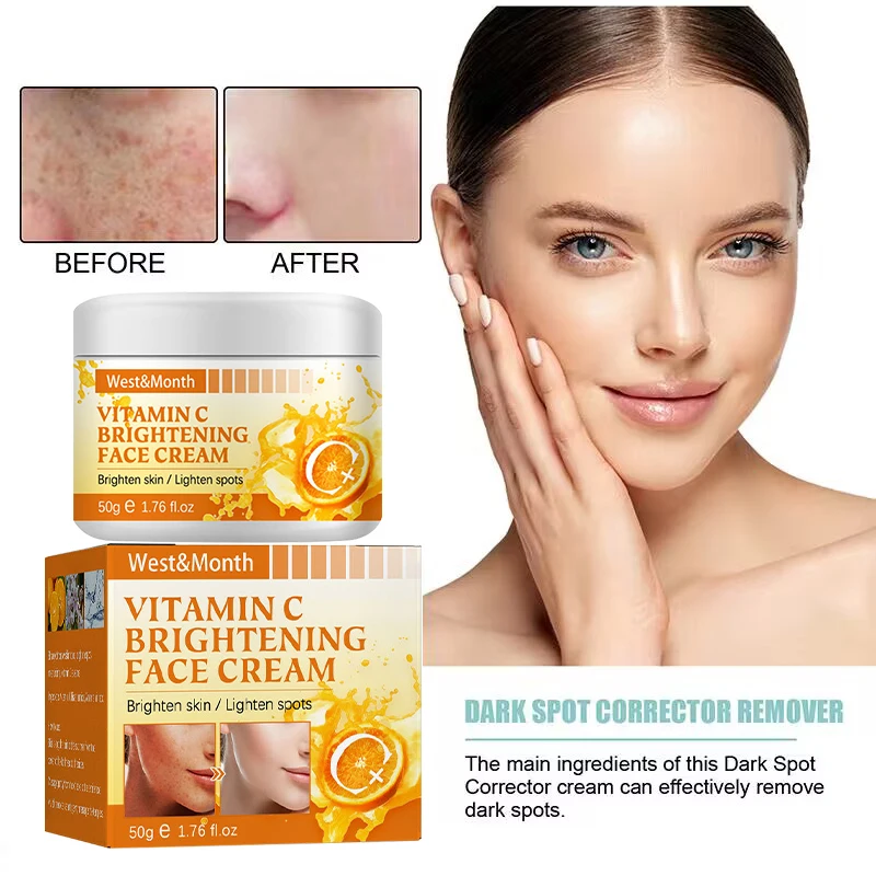 

Vitamin C Whitening Freckle Cream Fade Dark Spots Remove Acne Scars Melanin Pigmentation Brighten Anti-wrinkle Beauty Skin Care