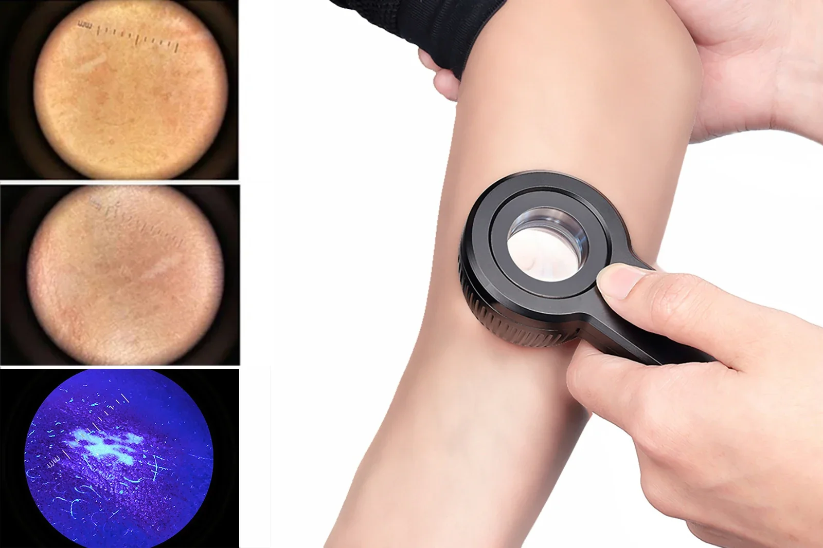 Электрический дерматоскоп De-3100 Pro с 10-кратным поляризационным светом и