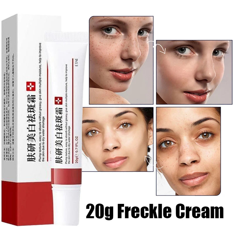 

20g Effective Whitening Freckle Cream Remove Acne Dark Spot Fade Pigmentation Melasma Brighten Anti Freckle Cream Face Skin Care