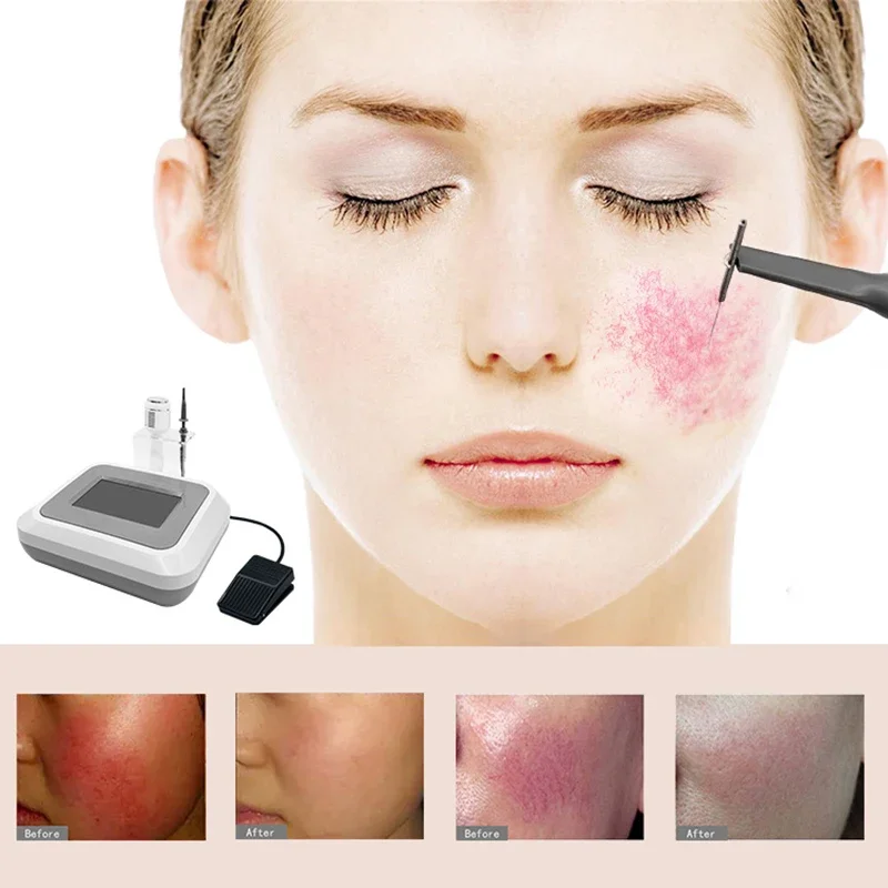 Rougeur для taches des équipement de beauty