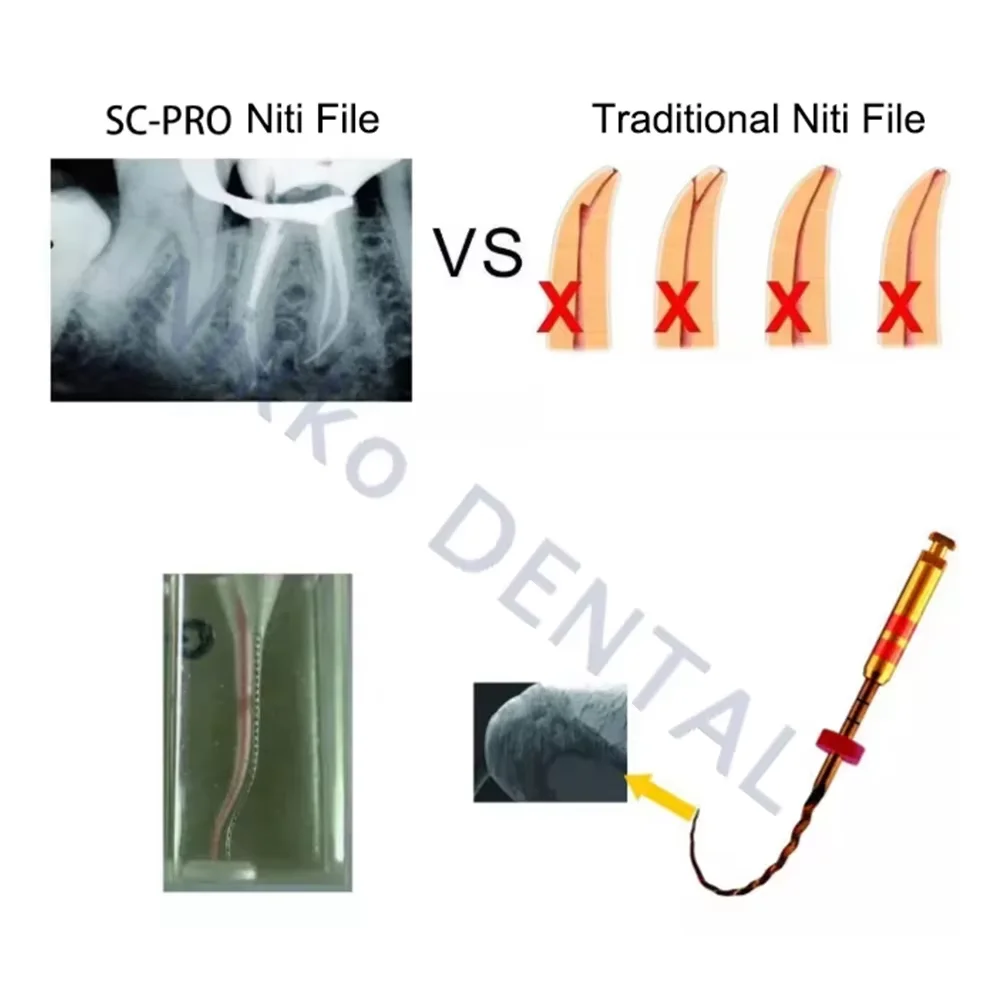 COXO 10/5 шт. стоматологические файлы нитинол роторный универсальный двигатель