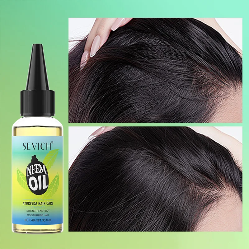 Ayurveda Neem Growth Oil Натуральные травяные сыворотки против выпадения волос Индия Масло