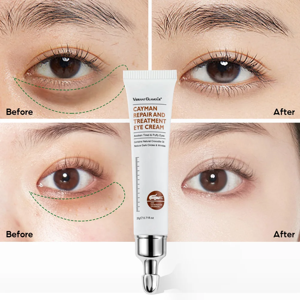

Vibrant Glamour 20ml Eye Cream Lift And Tighten To Remove Anti-Wrinkle And Fine Lines Under The Eyes Moisturizing Eye Care Cream
