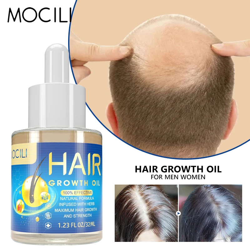 

Hair Growth Oil Prevent Hair Loss Oil Scalp Treatment Health Care Beauty Improve Hair Thinning Dry Frizzy Repair Nourish 32ml