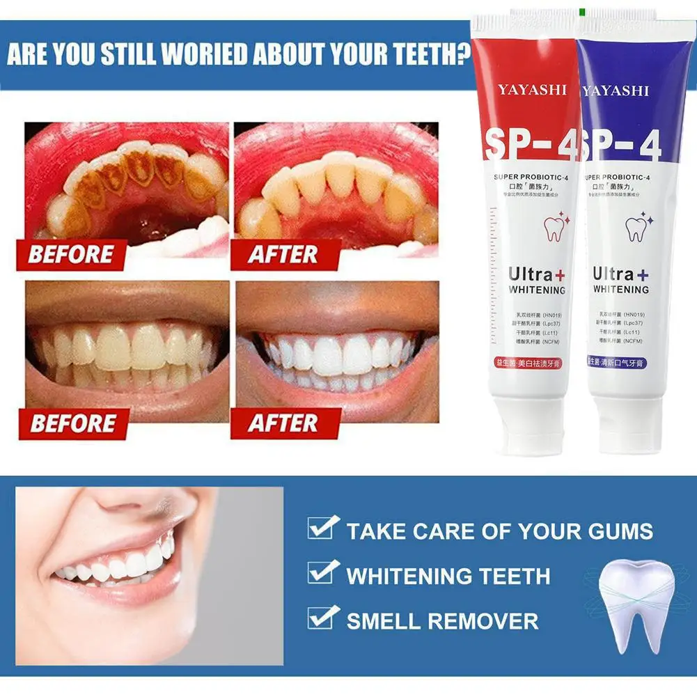 

120g Probiotic Whitening Shark Toothpaste Teeth Whitening Fresh Oral Plaque Breath Care Toothpaste Prevents Toothpaste J5R6