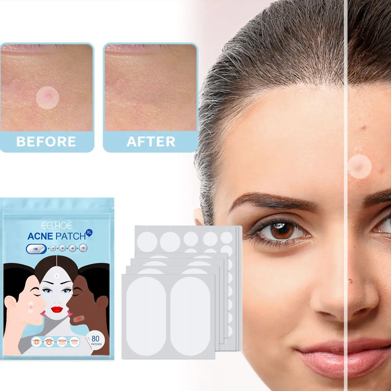 

80 шт., гидроколлоидное масло, невидимое масло для удаления акне