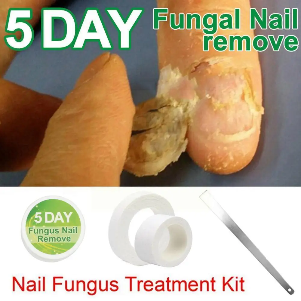 

Chinese Medicine Herbs Nail Fungus Treatment Anti Fungal Nail Treatment Removal Nail Nail Infection Lotion Care Essence K2m0