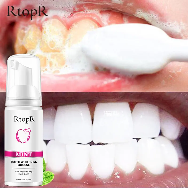 RtopR Teeth Whitening Mousse Remove Plaque Stains Serum Oral Hygiene Cleaning Bleaching Tooth Care Fresh Breath Dental Tool 60ml