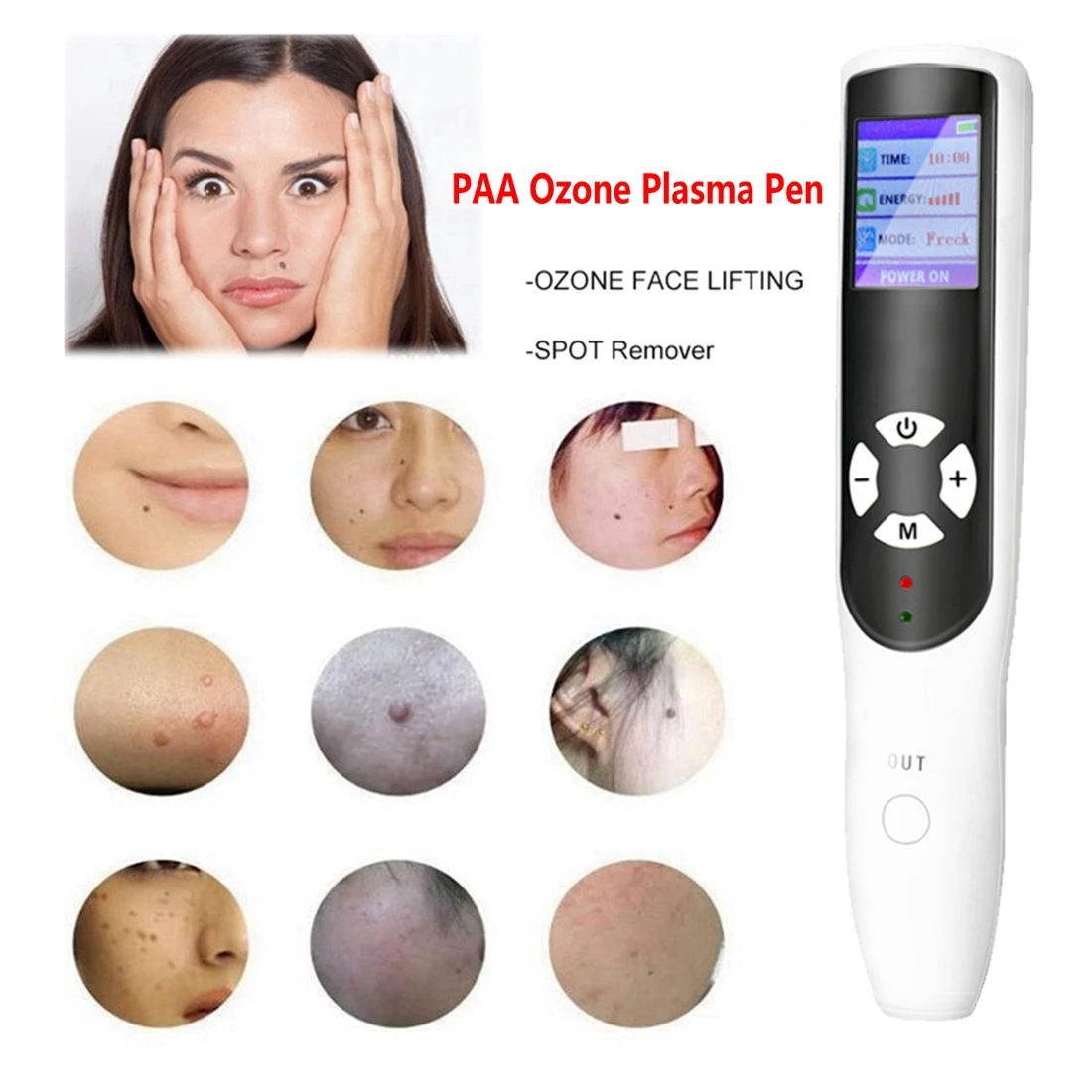 

PAA Ozone Plasma Pen Wart Freckle Removal Fibroblast Eyelid Lifting Pen Skin Mole Dark Spot Remover Acne Treatment Machine