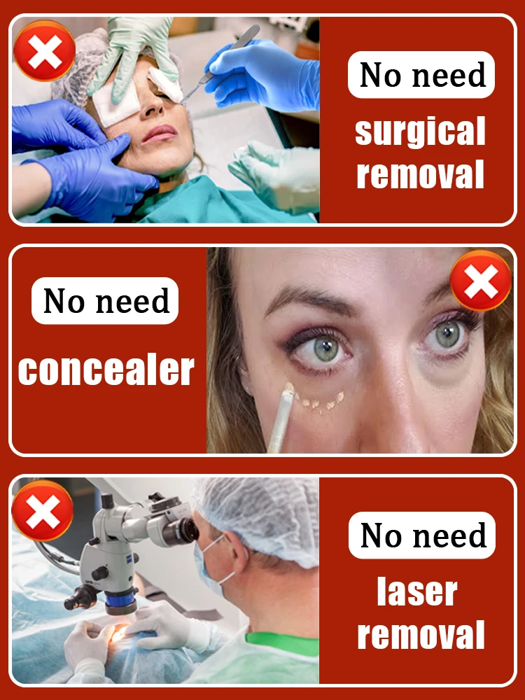 Избавление от разрывов