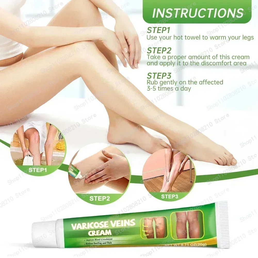 Оригинальное средство для снятия варикозного расширения вен