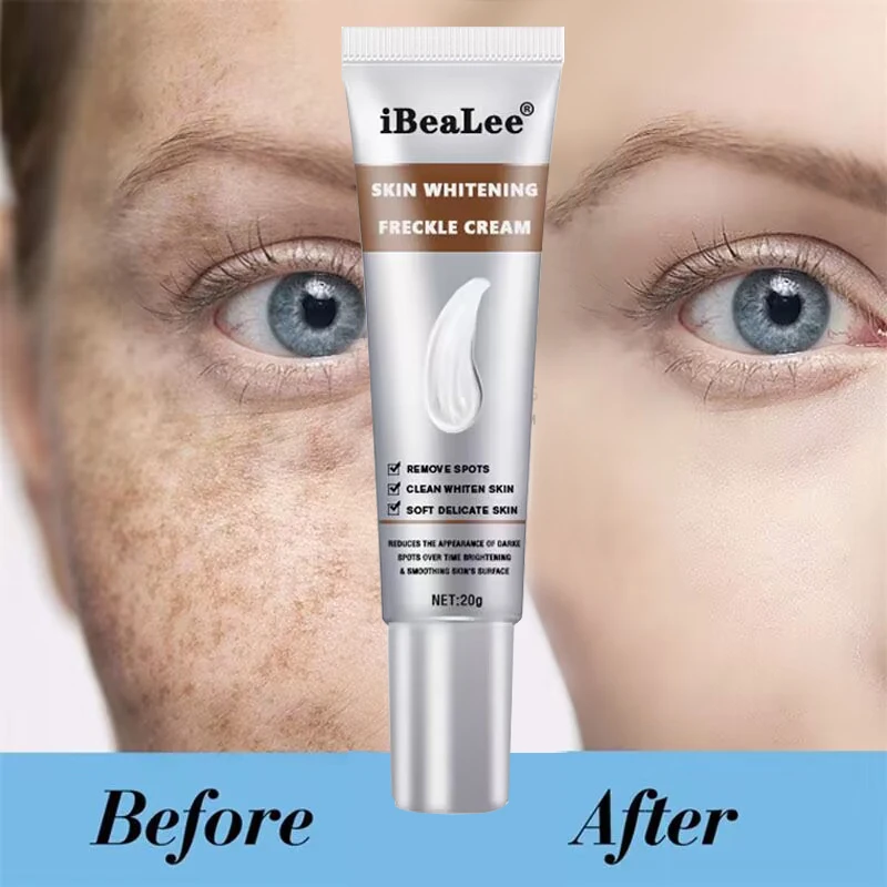 

Effective Whitening Freckle Cream Removal Melasma Acne Dark Spots Fade Pigment Melanin Corrector Moisturizing Brighten Skin Care