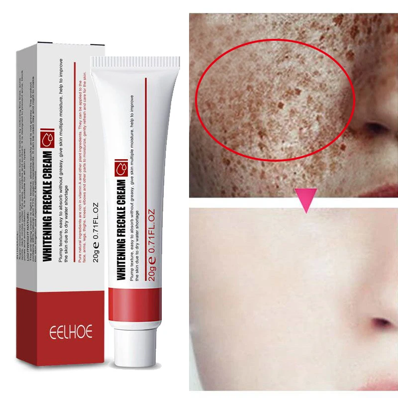 

Nicotinamide Whitening Freckles Cream Remove Melasma Acne Dark Spots Lighten Melanin Pigment Moisturizing Brighten Skin Care 20g