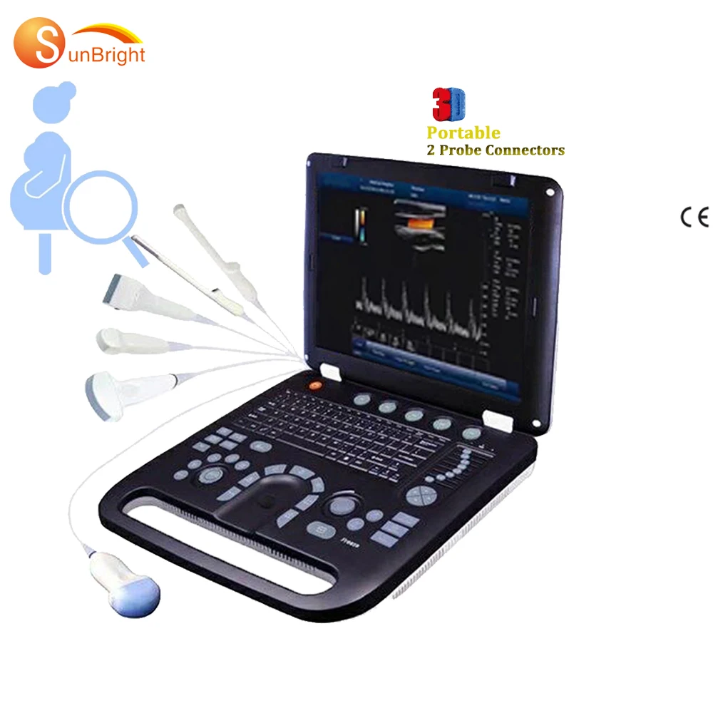 

Factory price portable ultrasound ecografo portatil diagnostic ultrasound 3D 4D color doppler SUN-906A