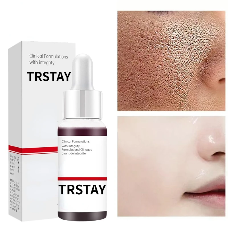 

New Face Serum Eliminate Essential Oils Essence Double Chin Replenishment Moisturize Shrink Pore Brighten Skin Care Firming