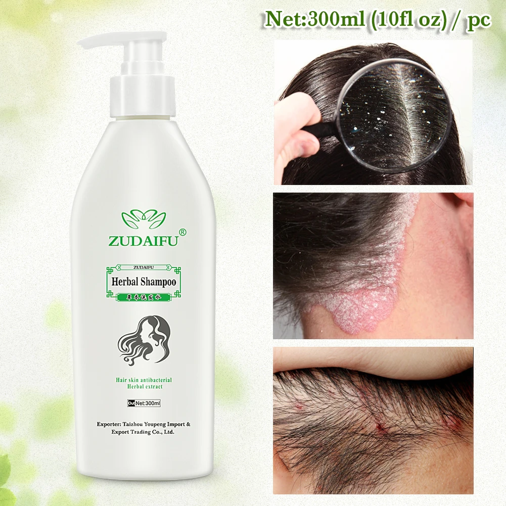 

New Arrival Zudaifu Herbal Psoriasis Treatment Dermatitis Eczematoid Complex Shampoo Ginseng Keratin Repair Shampoo Dropshipping