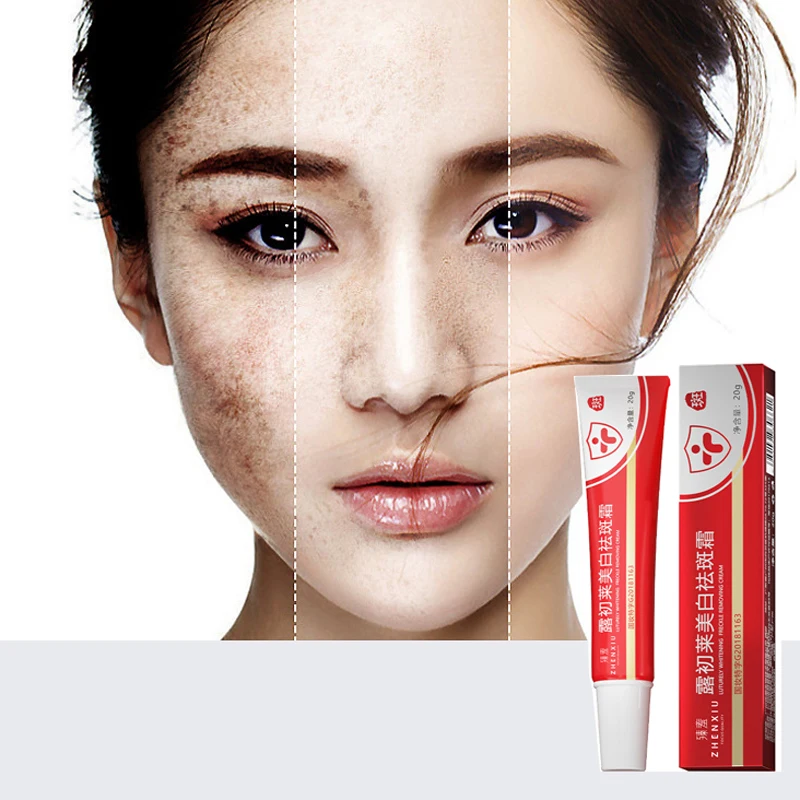 

Freckle Whitening Cream Black Dots Remover Anti Brown Stain Lighten Pigmentation Moisturizing Face Cream Skin Care Products