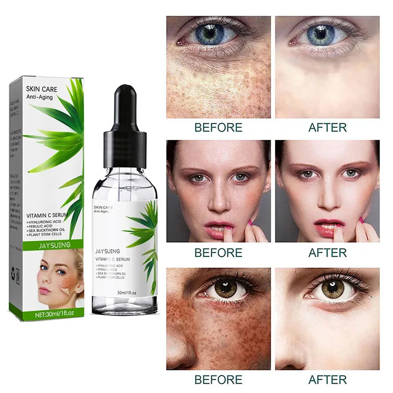 

Collagen Freckle Removal Face Serum Oil Control Fade Black Spots Shrink Pores Remove wrinkles Whitening Moisturizing Skin Care