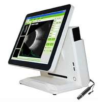 sab 500 portable 15 inch led touch screen ophthalmic ultrasound ab a b scan ultrasound