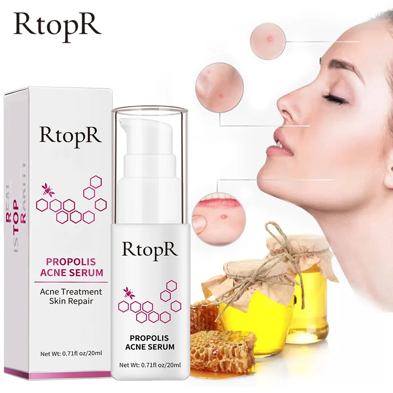 

RtopR Propolis Anti-Acne Brightening Serum Acne Scar Spots Removal Essence Shrink Pores Eliminates Acne-Treatment Oil-Control