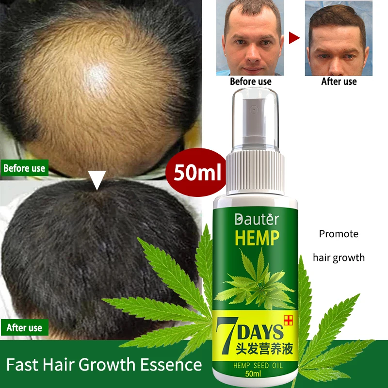 

Эссенция для роста волос, сыворотка с маслом быстрой регенерации, средство против выпадения волос, уход за кожей головы (10 / 30 / 50 мл)