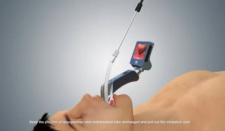 Ларингоскоп для видео цифровой ларингоскоп многоразовый набор