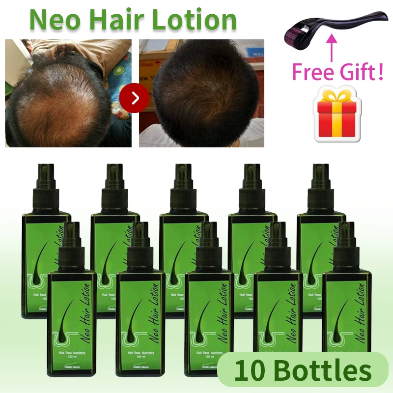 

10pcs Hot sale Neo Hair lotion Hair Growth Serum Essence Oil Hair Loss Treatment Growth Hair Care for Men Women Thailand 120ml