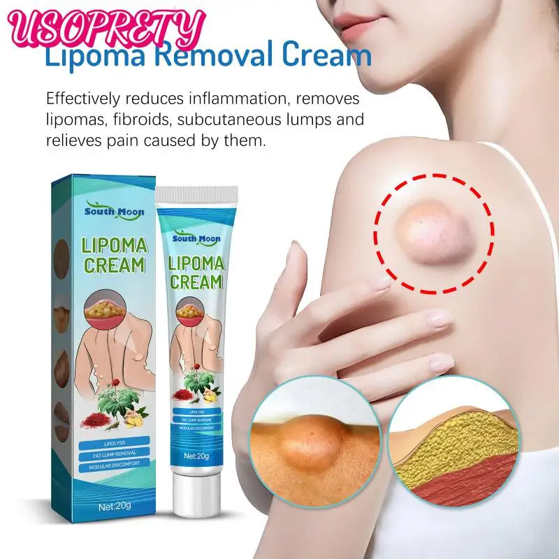 

Natural Plant Lipoma Removal Cream Extract Treatments Plaster Removes Lipomas Fibroids Subcutaneous Lumps Pain Relief Skin Care