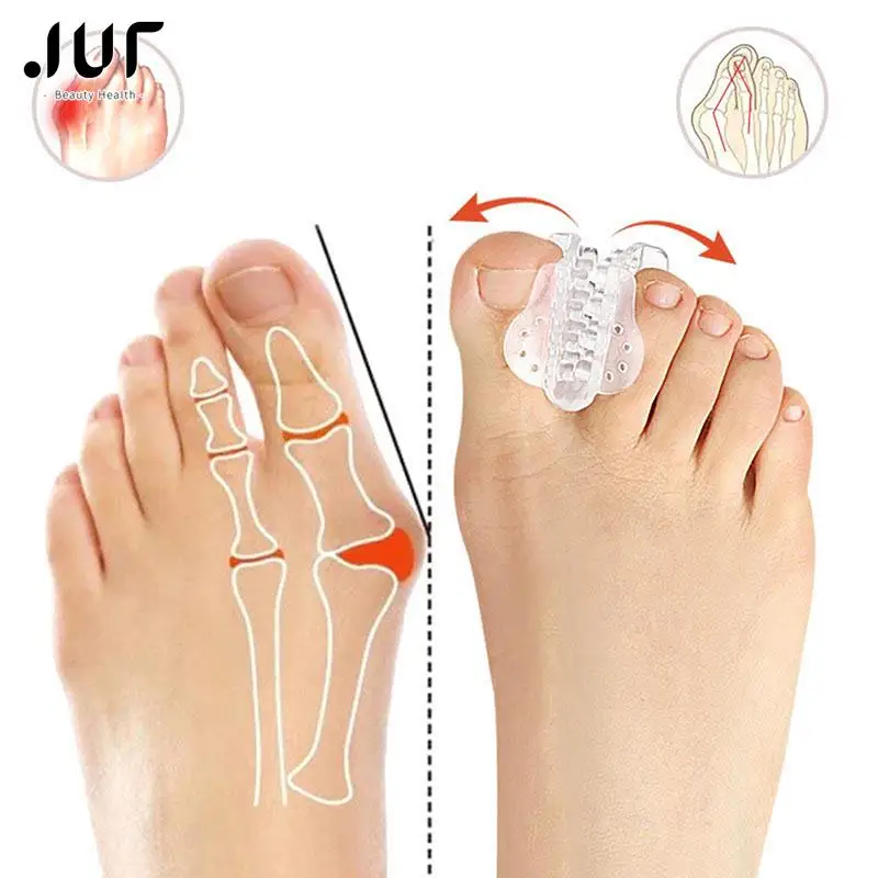 

Силиконовые разделители для пальцев ног, защита для ног, Силиконовые ортопедические средства для пальцев ног, коррекция бурсита, вальгусная деформация, педикюр, уход за ногами