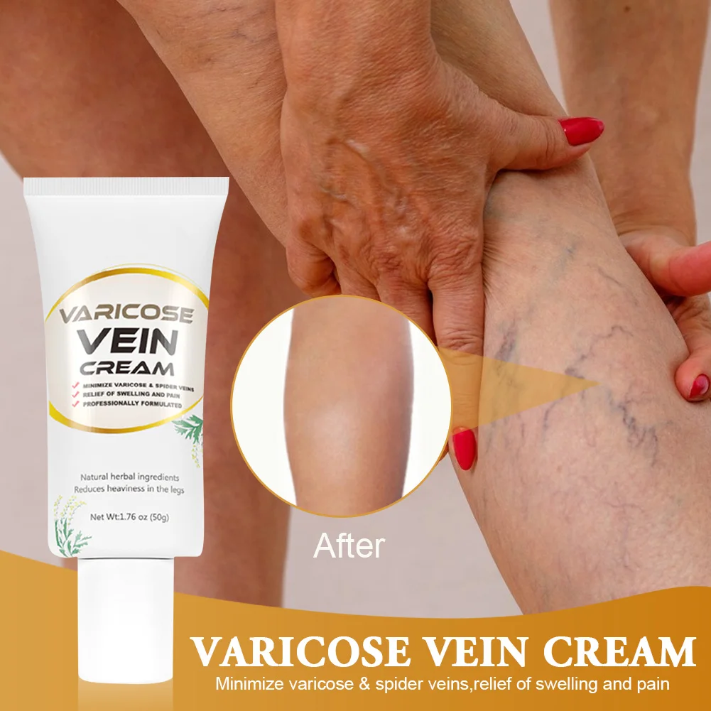 

50g Varicose Vein Cream Soothing Repair Pain Relief Cream Promotes Blood Circulation Phlebitis Spider Vein Herbal Body Care