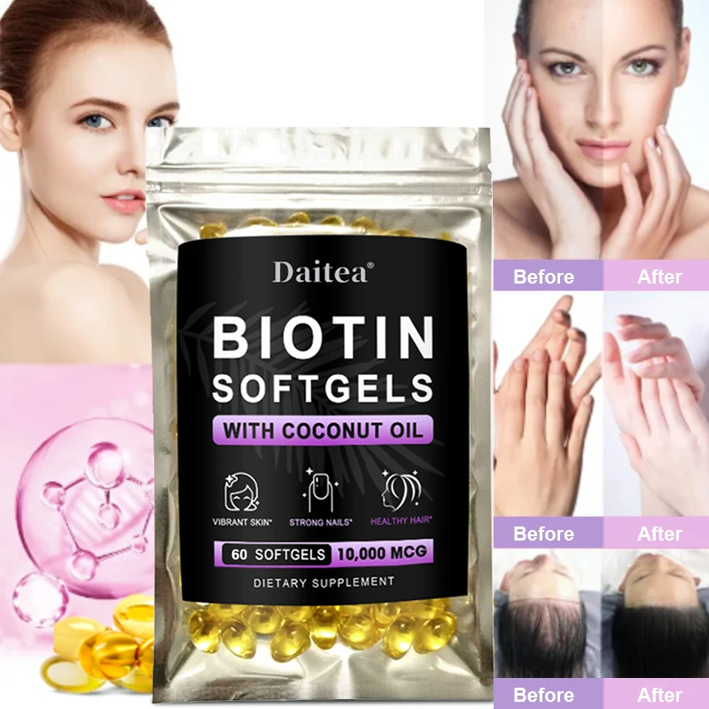 

Biotin Softgels - Aids Hair Growth, Nails, Skin Health and Radiance, Anti-aging, Boosts Metabolism, Increases Energy