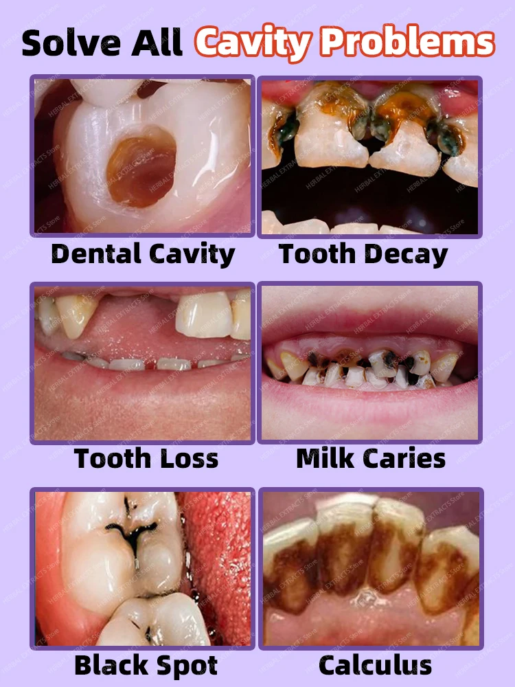 Надежная Стоматологическая паста Предотвращает кариес отбеливание зубов