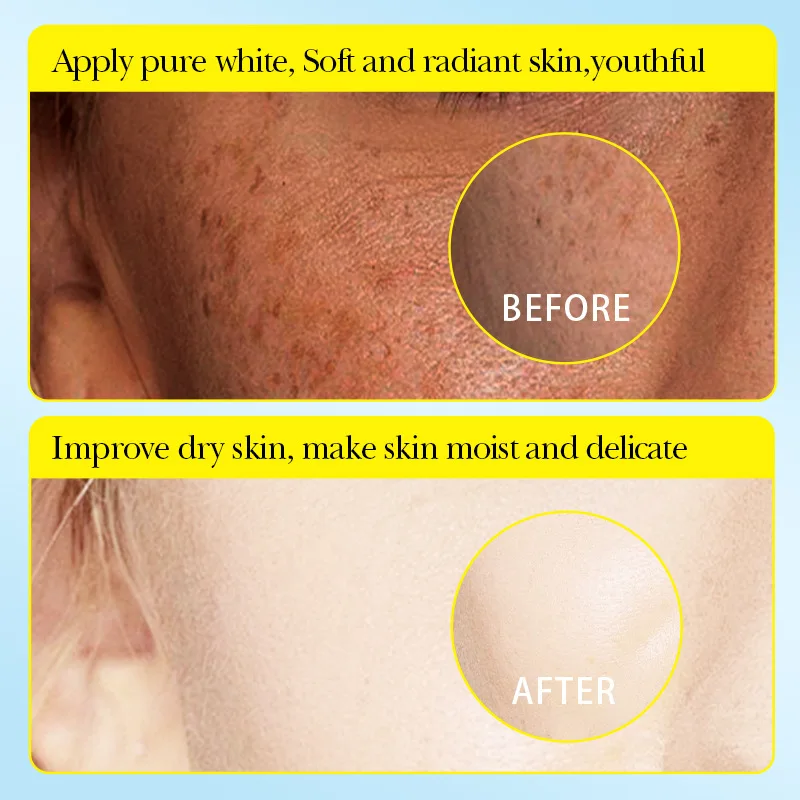 Набор из 10 предметов лимонная увлажняющая маска для лица коллагеновая