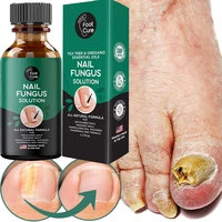 50ml fungal nail repair essence feet caretreatment foot toe nail fungus removal gel anti infection paronychia onychomycosis care