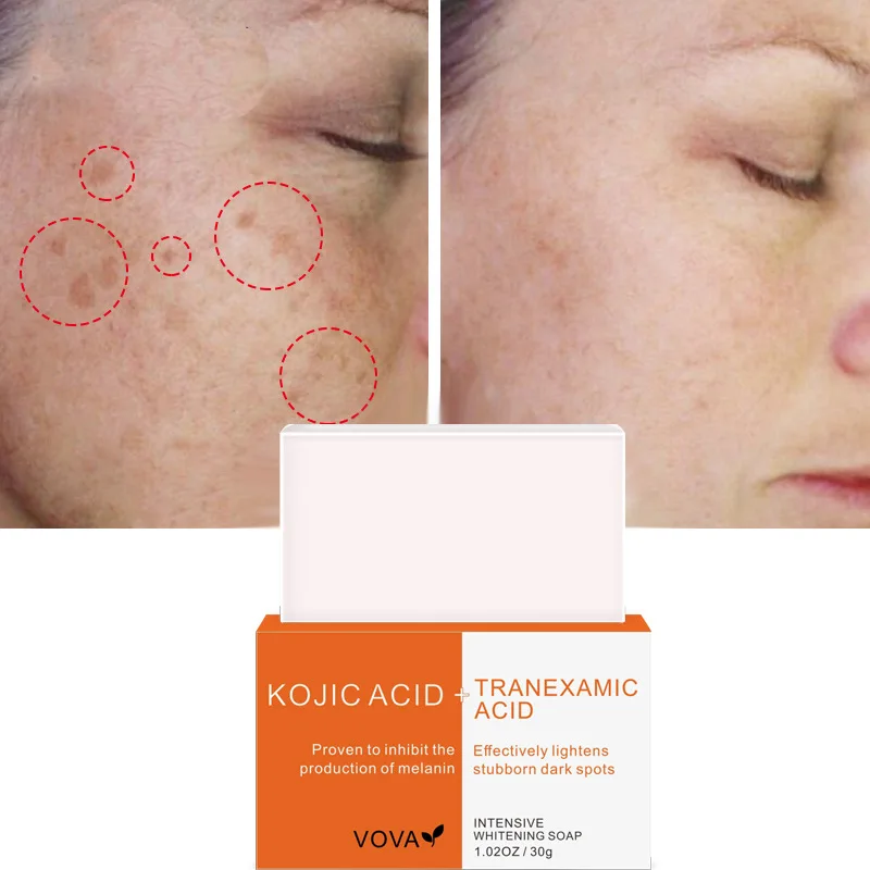 

30g Kojic Acid + Tranexamic Acid Face Soap Mite Removal Soap Cleansing Fragrance Face Wash Soap Oil Control face soap