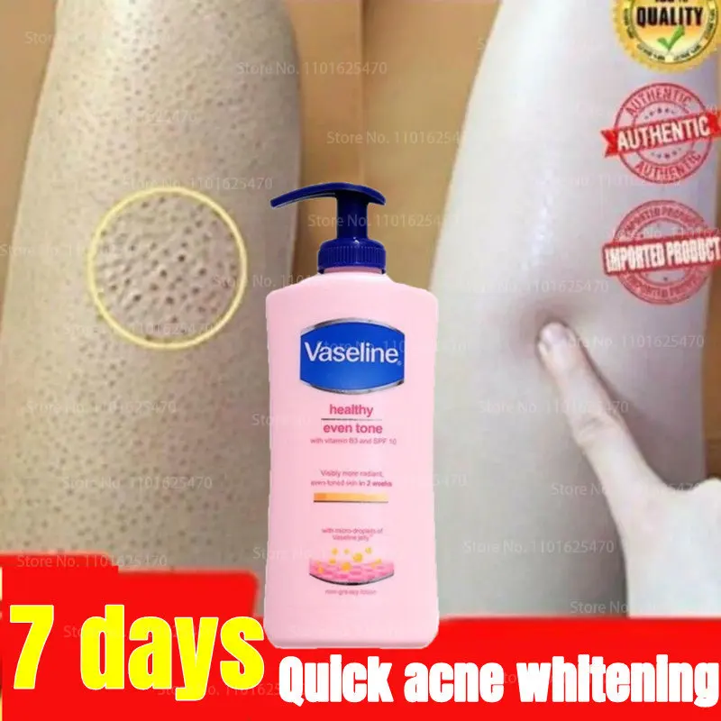 400ML Vaseline Body Lotion for Men and Women Remove Chicken Skin Moisturizing Whitening Body Moisturizing Fragrance Body Cream