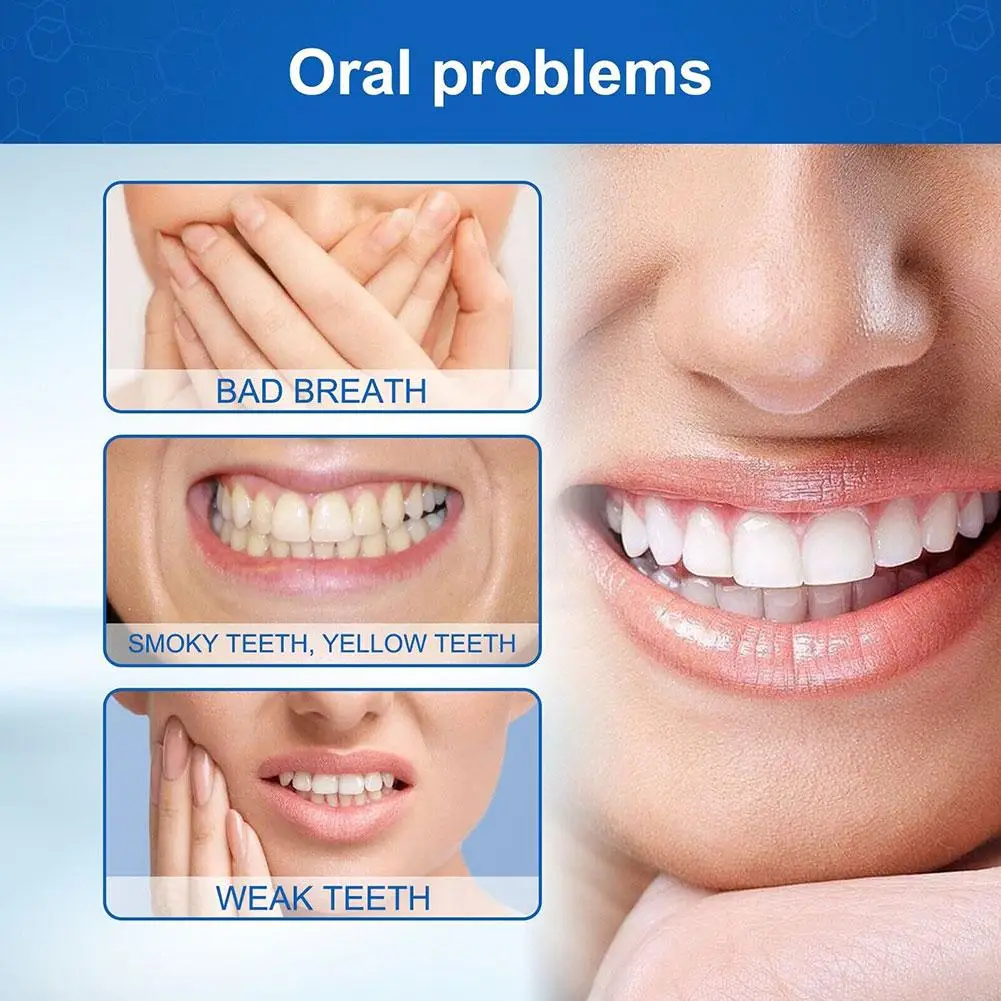 

Отбеливающая зубная паста с пробиотической содой, 100 г, быстрая чистка зубов, восстановление темных полостей рта, пятна от удаления H8O3