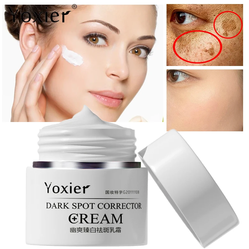 

Face Cream Moisturizing Whitening Remove Dark Spots Chloasma Sunburn Anti-Aging Anti-Wrinkle Lighten Pigmentation Repair 30g