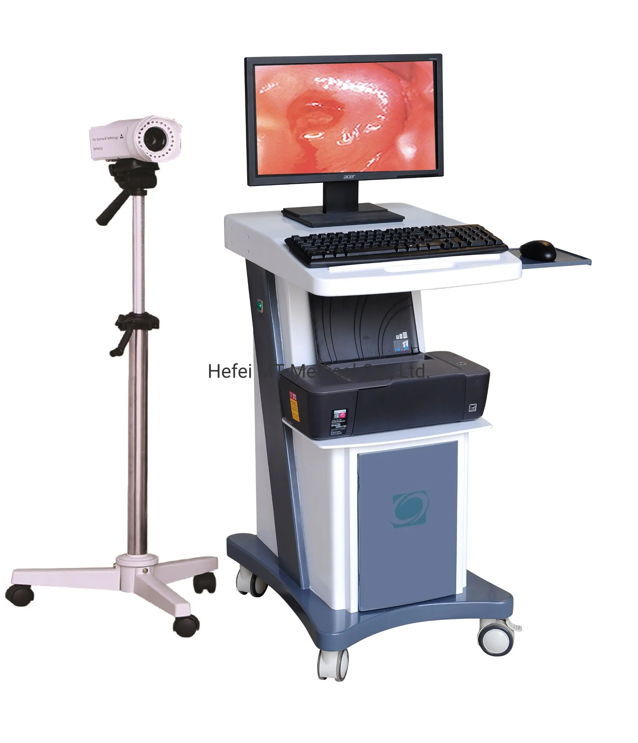 

MT Medical Ready to Ship High-Quality Coloposcopes for Numerous Colposcopy Procedures Gynecology HD Digital Video Colposcope