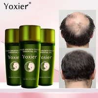 3pcs hair growth essential oil fast growing thick hair oils treatment prevent hair loss serum repair nourish hair root men women