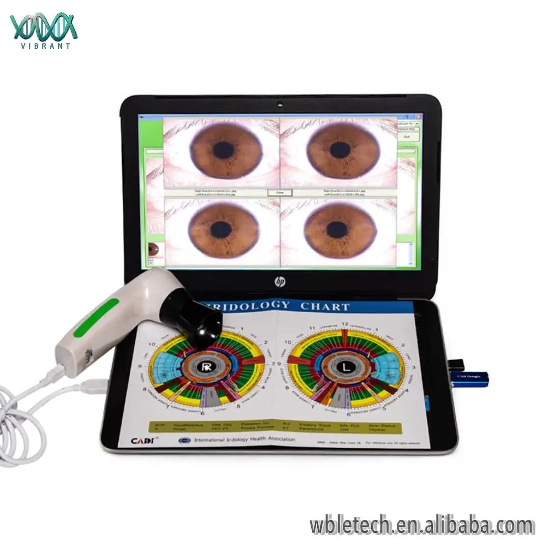 Hi-Accuracy  professional portable 5mp iriscope iris analyzer iridology camera with pro iris