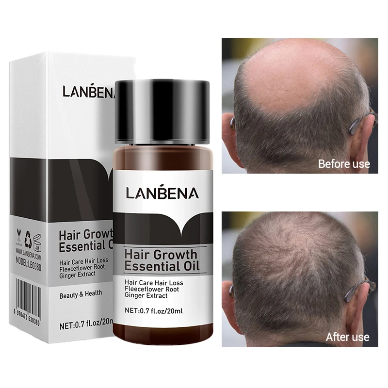 

Anti-Hair Loss Hair Growth Essence Scalp Care Liquid Natural Polygonum Multiflorum Ginseng Extract Ginger Healthy Hair Care 20ml
