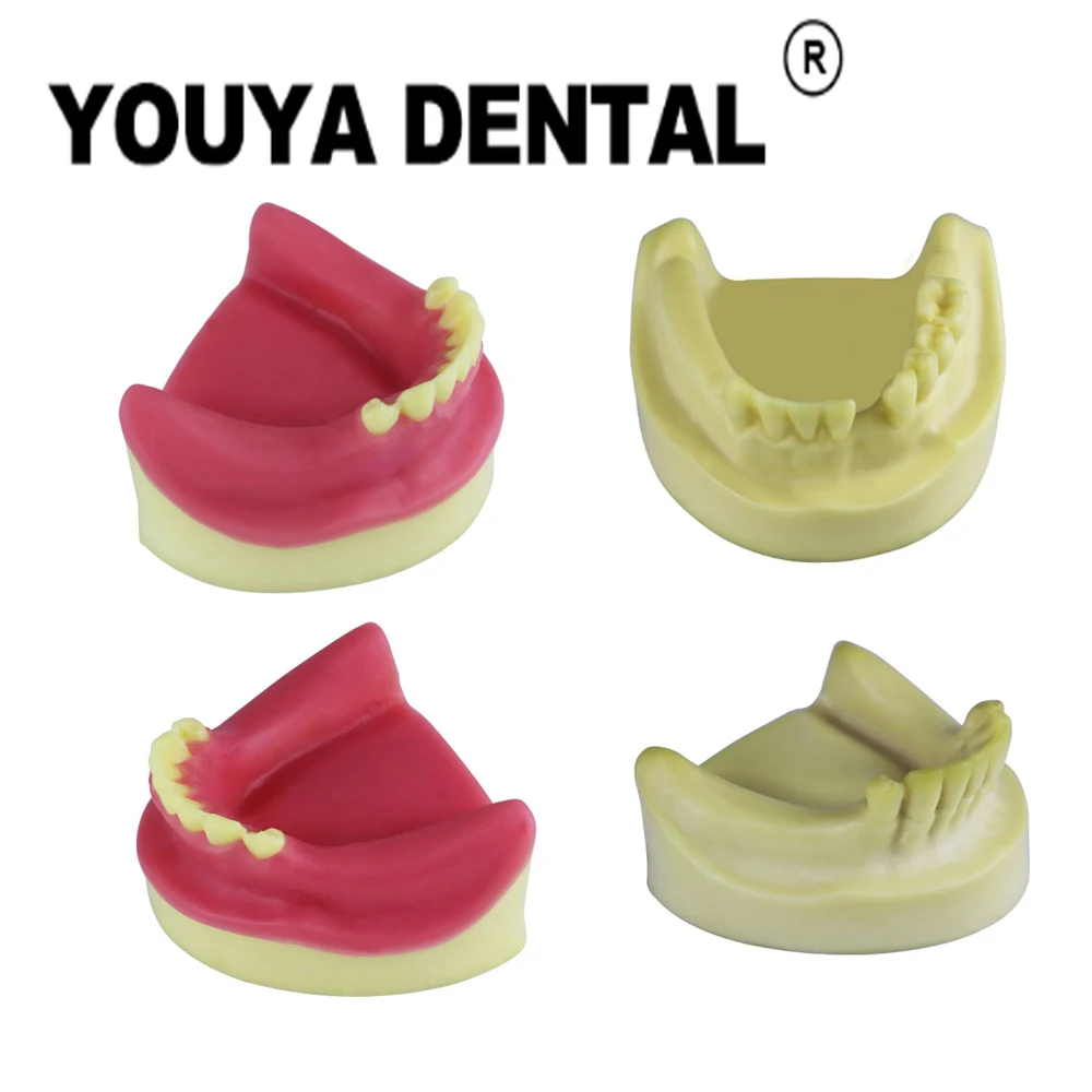 

Dental Jaw Practice Model Mandibular Missing Implant Training Models Dentist Equipment Oral Hygiene Dental Study Teaching Model