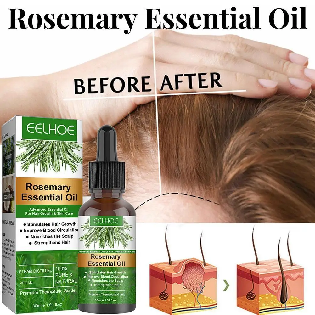 

Eelhoe Rosemary Oil Fast Growing Anti Hair Loss Essential Oil Repair Damage Baldness Scalp Product Hairs Smooth Care