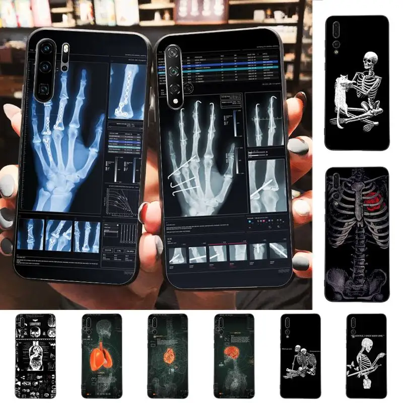 

Radiological human organs Skeleton skull Phone Case for Huawei P30 40 20 10 8 9 lite pro plus Psmart2019