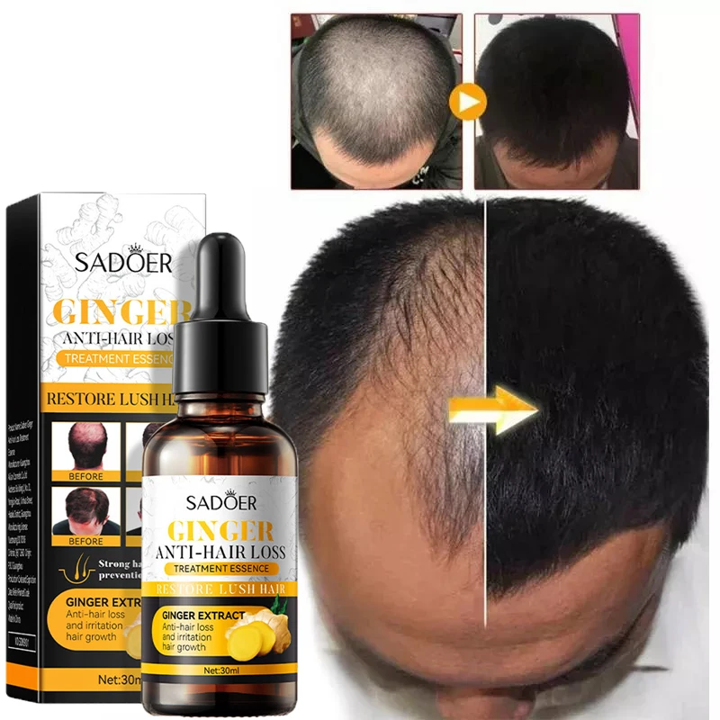 Ginger Hair Growth Essence Anti Hair Loss Treatment Essential Oil Repair Damaged Hair Prevent Baldness Hair Care Products 30ml
